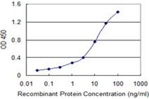 Detection limit for recombinant GST tagged SP100 is 0. (SP100 antibody  (AA 1-98))