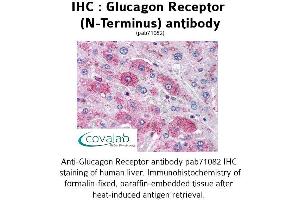 Image no. 1 for anti-Glucagon Receptor (GCGR) (Extracellular Domain), (N-Term) antibody (ABIN1734753) (Glucagon Receptor antibody  (Extracellular Domain, N-Term))