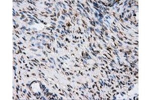 Immunohistochemical staining of paraffin-embedded Kidney tissue using anti-ATP5Bmouse monoclonal antibody. (ATP5B antibody)