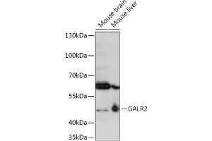 Western blot analysis of extracts of various cell lines, using G antibody (ABIN7267335) at 1:1000 dilution. (GALR2 antibody  (AA 50-150))