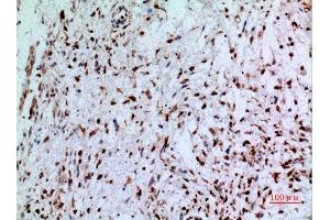Immunohistochemistry (IHC) analysis of paraffin-embedded Human Brain, antibody was diluted at 1:100.