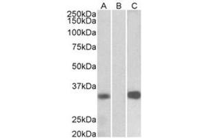Western Blotting (WB) image for anti-Kv Channel Interacting Protein 3, Calsenilin (KCNIP3) (Internal Region) antibody (ABIN1105646) (DREAM antibody  (Internal Region))