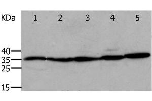 Western Blot analysis of Mouse eyes and heart, Human cervical cancer tissue, OP9 and RAW264. (Annexin V antibody)