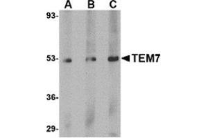 Western blot analysis of TEM7 in human liver tissue lysate with this product at (A) 0.