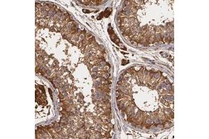 Immunohistochemical staining of human testis with CYB5R3 polyclonal antibody  shows strong cytoplasmic positivity in cells in seminiferus ducts and Leydig cells at 1:1000-1:2500 dilution.