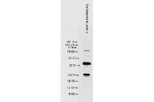 Western blot analysis of Rat Skeletal muscle lysates showing detection of HSP22 protein using Rabbit Anti-HSP22 Polyclonal Antibody . (HSPB8 antibody  (Atto 390))