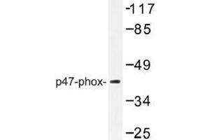 Image no. 1 for anti-Neutrophil Cytosol Factor 1 (NCF1) antibody (ABIN317896) (NCF1 antibody)