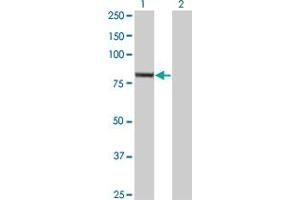 Western Blot analysis of EXOC3 expression in transfected 293T cell line by EXOC3 monoclonal antibody (M01), clone 4A7. (EXOC3 antibody  (AA 646-745))
