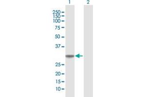 Western Blot analysis of COASY expression in transfected 293T cell line by COASY MaxPab polyclonal antibody. (COASY antibody  (AA 1-269))