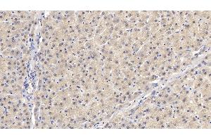 Immunohistochemistry (IHC) image for anti-SMAD, Mothers Against DPP Homolog 3 (SMAD3) (AA 231-425) antibody (ABIN7426472)
