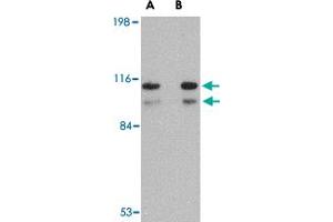 Western blot analysis of SATB1 in SK-N-SH cell lysate with SATB1 polyclonal antibody  at (A) 1 and (B) 2 ug/mL . (SATB1 antibody  (N-Term))