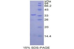 SDS-PAGE analysis of Mouse SPINK5 Protein. (SPINK5 Protein)
