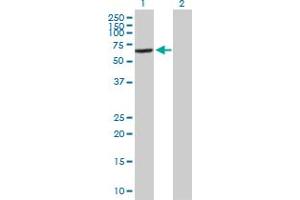 Western Blot analysis of VPS45 expression in transfected 293T cell line by VPS45 MaxPab polyclonal antibody. (VPS45 antibody  (AA 1-570))