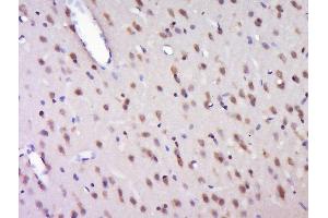 Paraformaldehyde-fixed, paraffin embedded rat brain, Antigen retrieval by boiling in sodium citrate buffer (pH6) for 15min, Block endogenous peroxidase by 3% hydrogen peroxide for 30 minutes, Blocking buffer (normal goat serum) at 37°C for 20min, Antibody incubation with HELZ Polyclonal Antibody, Unconjugated  ) at 1:500 overnight at 4°C, followed by a conjugated secondary and DAB staining. (HELZ antibody  (AA 1-100))