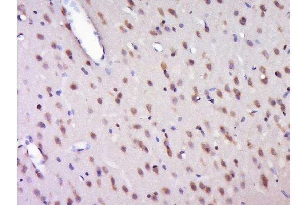 HELZ antibody  (AA 1-100)