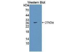 Western blot analysis of the recombinant protein. (PEX1 antibody  (AA 172-377))