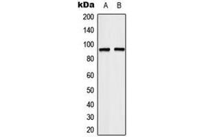 Western blot analysis of TCEB3 expression in HeLa (A), Jurkat (B) whole cell lysates. (TCEB3 antibody  (Center))