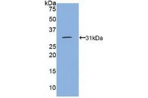Detection of Recombinant DEP1, Human using Polyclonal Antibody to Density Enhanced Phosphatase 1 (DEP1) (PTPRJ antibody  (AA 1061-1293))