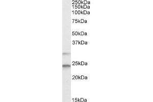 Western Blotting (WB) image for anti-MAD2 Mitotic Arrest Deficient-Like 1 (Yeast) (MAD2L1) antibody (ABIN5928342) (MAD2L1 antibody)