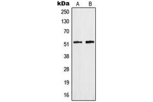 Western blot analysis of hnRNP F expression in HepG2 (A), Jurkat (B) whole cell lysates.