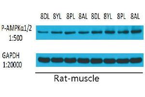 Western Blot (WB) analysis: Please contact us for more details. (PRKAA1/PRKAA2 antibody  (pThr172, pThr183))