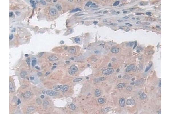 ASAH1 antibody  (AA 144-395)