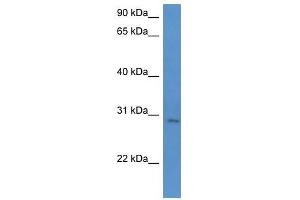 Western Blot showing UTP23 antibody used at a concentration of 1-2 ug/ml to detect its target protein. (UTP23 antibody  (C-Term))