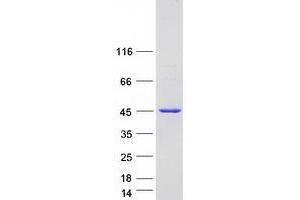 Validation with Western Blot