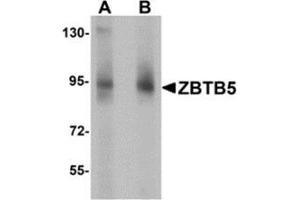 Western blot analysis of ZBTB5 in mouse brain tissue lysate with ZBTB5 antibody at (A) 1 and (B) 2 μg/ml.