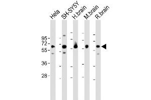 Western Blot at 1:1000-1:2000 dilution Lane 1: Hela whole cell lysate Lane 2: SH-SY5Y whole cell lysate Lane 3: H.