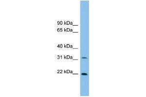 WB Suggested Anti-Foxn2 Antibody Titration: 0.