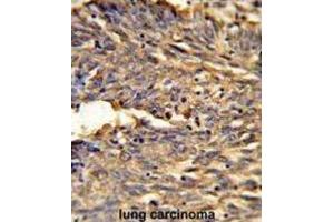 Immunohistochemistry (IHC) image for anti-Hemoglobin, alpha 2 (HBa2) antibody (ABIN2932211) (HBa2 antibody)