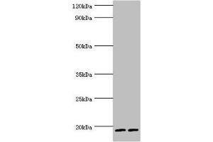 Western blot All lanes: Serglycin antibody at 9 μg/mL Lane 1: THP-1 whole cell lysate Lane 2: HL60 whole cell lysate Secondary Goat polyclonal to rabbit IgG at 1/10000 dilution Predicted band size: 18 kDa Observed band size: 18 kDa (SRGN antibody  (AA 28-158))