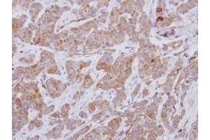 Image no. 2 for anti-Rho Guanine Nucleotide Exchange Factor 25 (ARHGEF25) (AA 226-446) antibody (ABIN1496711) (ARHGEF25/GEFT antibody  (AA 226-446))