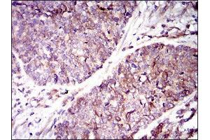 Immunohistochemistry (IHC) image for anti-Guanylate Cyclase 1 Soluble Subunit Alpha (GUCY1A1) (AA 22-214) antibody (ABIN1845103) (GUCY1A1 antibody  (AA 22-214))