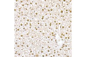 Immunohistochemistry of paraffin-embedded rat Intestine using MUC2 Rabbit pAb (ABIN7268690) at dilution of 1:300 (40x lens). (MUC2 antibody  (AA 4850-4950))