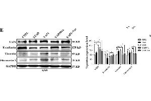 TEAD is involved in YAP1-induced EMT in A549 cells. (GAPDH antibody)