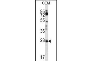 Western blot analysis in CEM cell line lysates (35ug/lane). (RARRES1 antibody  (C-Term))