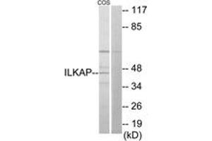 Western blot analysis of extracts from COS7 cells, using ILKAP Antibody. (ILKAP antibody  (AA 41-90))