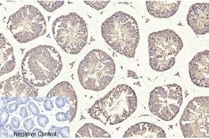 Immunohistochemical analysis of paraffin-embedded mouse testis tissue. (TUBB1 antibody)