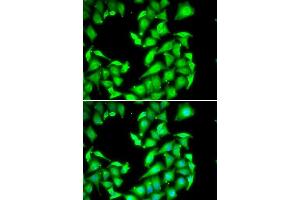 Immunofluorescence analysis of HeLa cells using PPM1A antibody. (PPM1A antibody  (AA 1-382))