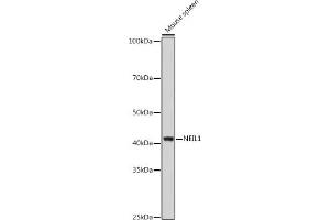 Western blot analysis of extracts of Mouse spleen, using NEIL1 antibody (ABIN6130579, ABIN6144514, ABIN6144515 and ABIN6221523) at 1:1000 dilution. (NEIL1 antibody  (AA 187-476))