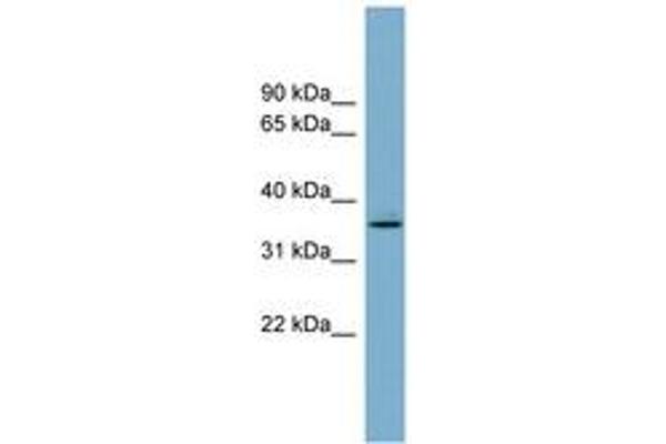 AWAT1 antibody  (AA 107-156)