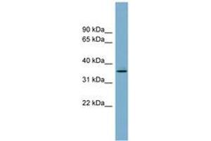 Image no. 1 for anti-Acyl-CoA Wax Alcohol Acyltransferase 1 (AWAT1) (AA 107-156) antibody (ABIN6743322) (AWAT1 antibody  (AA 107-156))