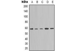 Western blot analysis of NOTCH4 expression in A549 (A), K562 (B), Hela (C), mouse brain (D), NIH3T3 (E) whole cell lysates. (NOTCH4 antibody  (C-Term))