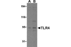 Western blot analysis of TLR4 in PC-3 cell lysates with this product at (A) 2. (TLR4 antibody  (N-Term))