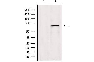 Western blot analysis of extracts from HepG2, using LGTN Antibody. (EIF2D antibody  (Internal Region))