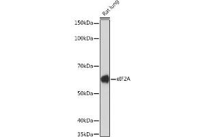 Western blot analysis of extracts of Rat lung, using eIF2A Rabbit mAb (ABIN7267035) at 1:1000 dilution. (EIF2A antibody)