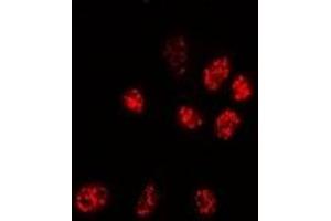 Immunofluorescent analysis of PPP3CA staining in Hela cells. (PPP3CA antibody)