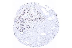 breast (Recombinant CNN1 antibody  (C-Term))